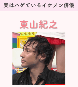 M字はげ芸能人を一挙紹介！一般男性の差が分かる実用ガイド付き