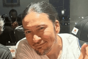 M字はげ芸能人を一挙紹介！一般男性の差が分かる実用ガイド付き